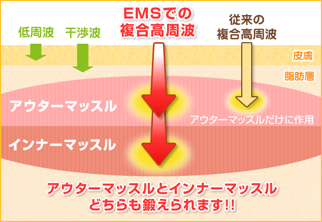 EMSでの複合高周波